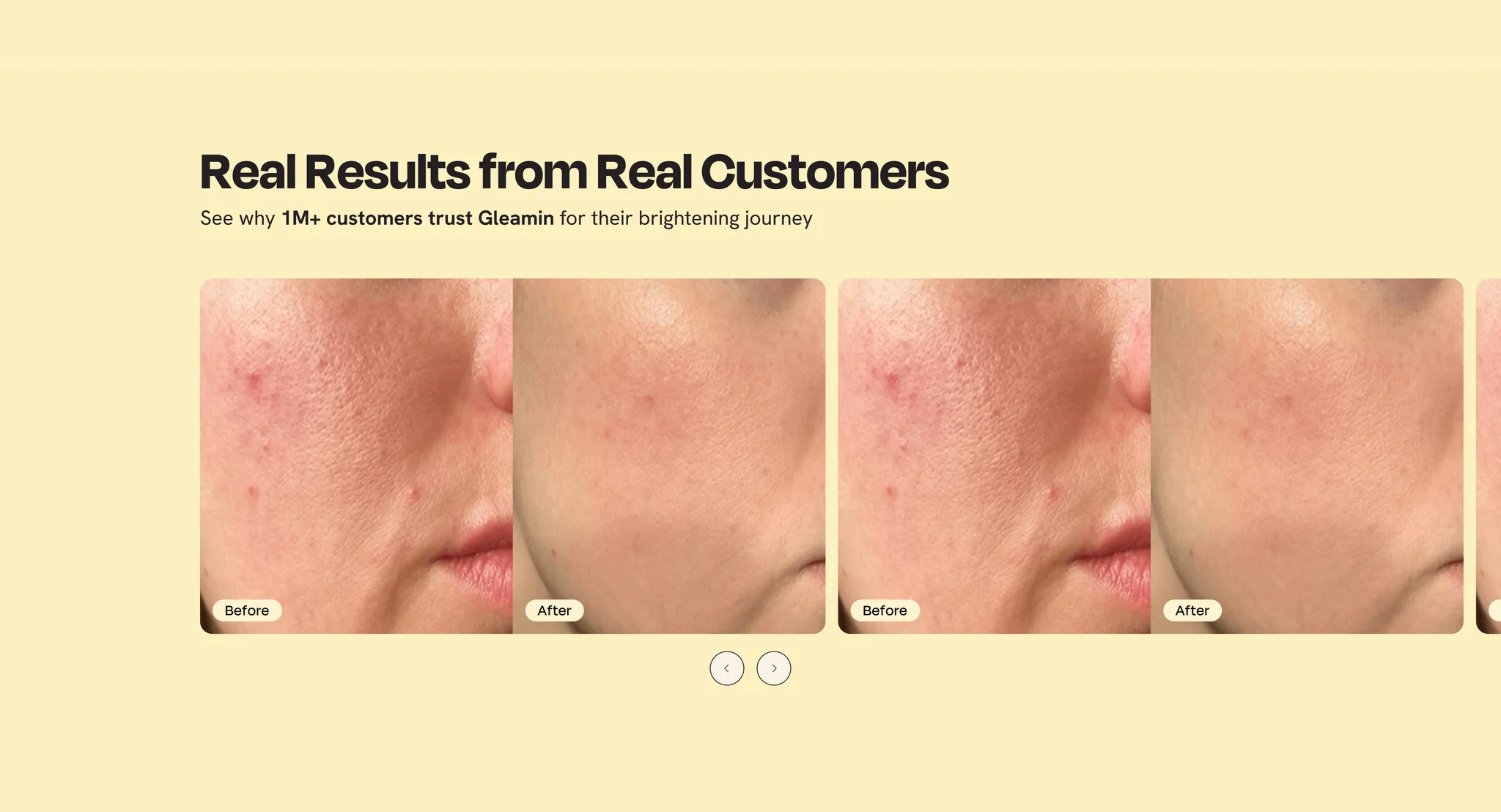 "Real Results from Real Customers" carousel of before and after skin photos on the homepage