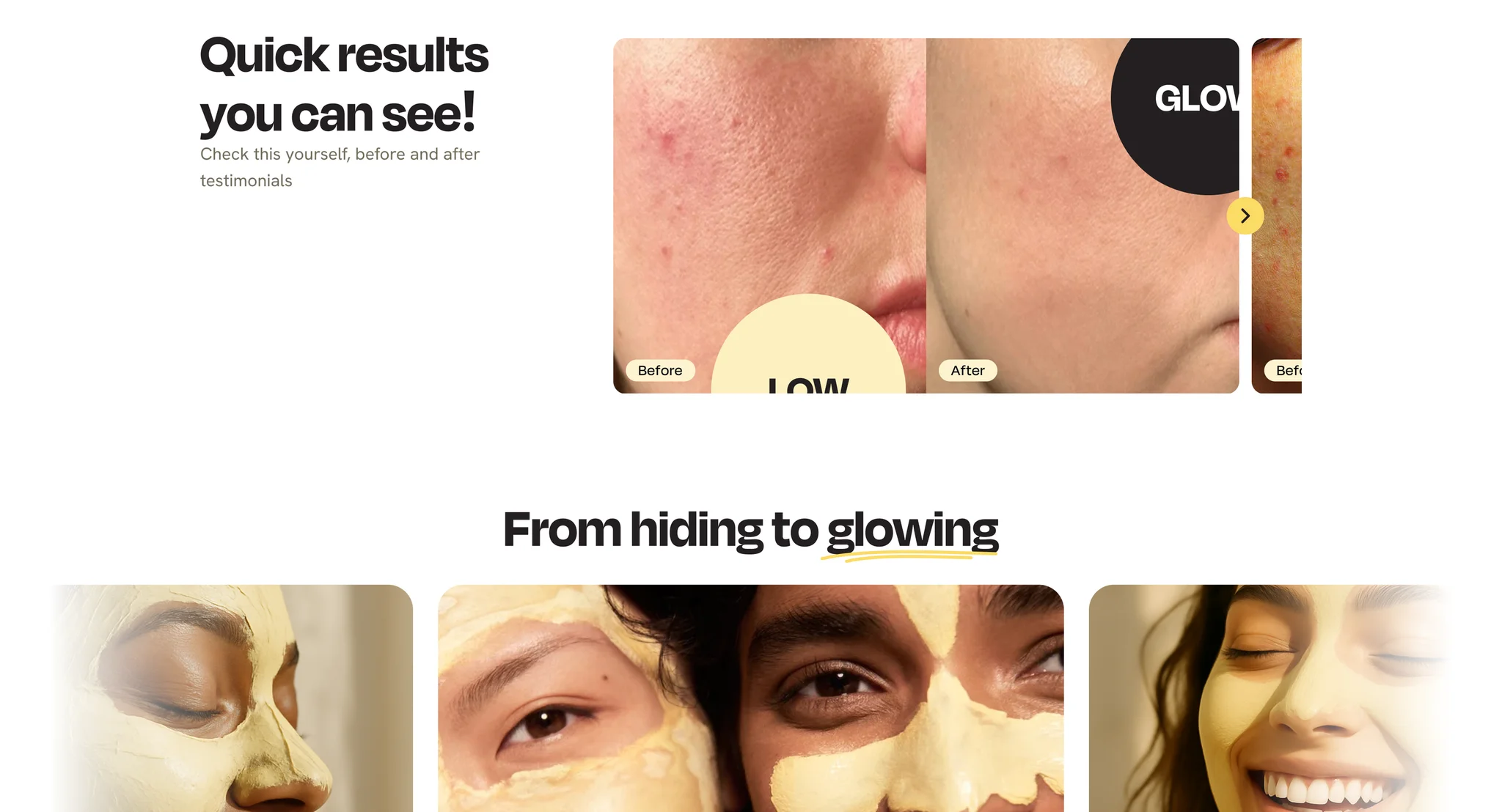 "Quick results you can see!" before and after slider and the "From hiding to glowing" photo row on the product page