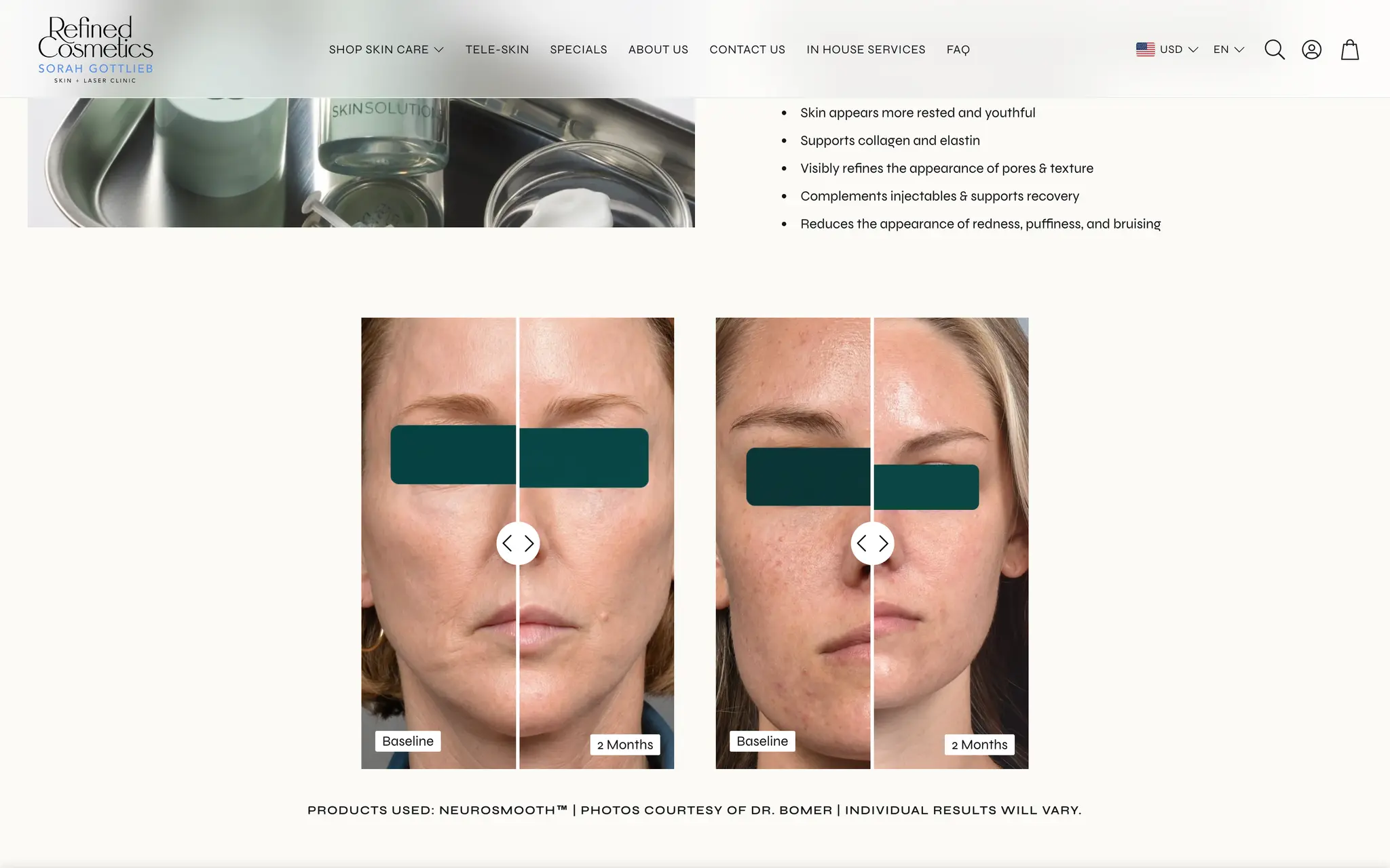 Benefit list and paired clinical before-and-after photographs at baseline and two months on the Refined Cosmetics NeuroSmooth Serum product page.