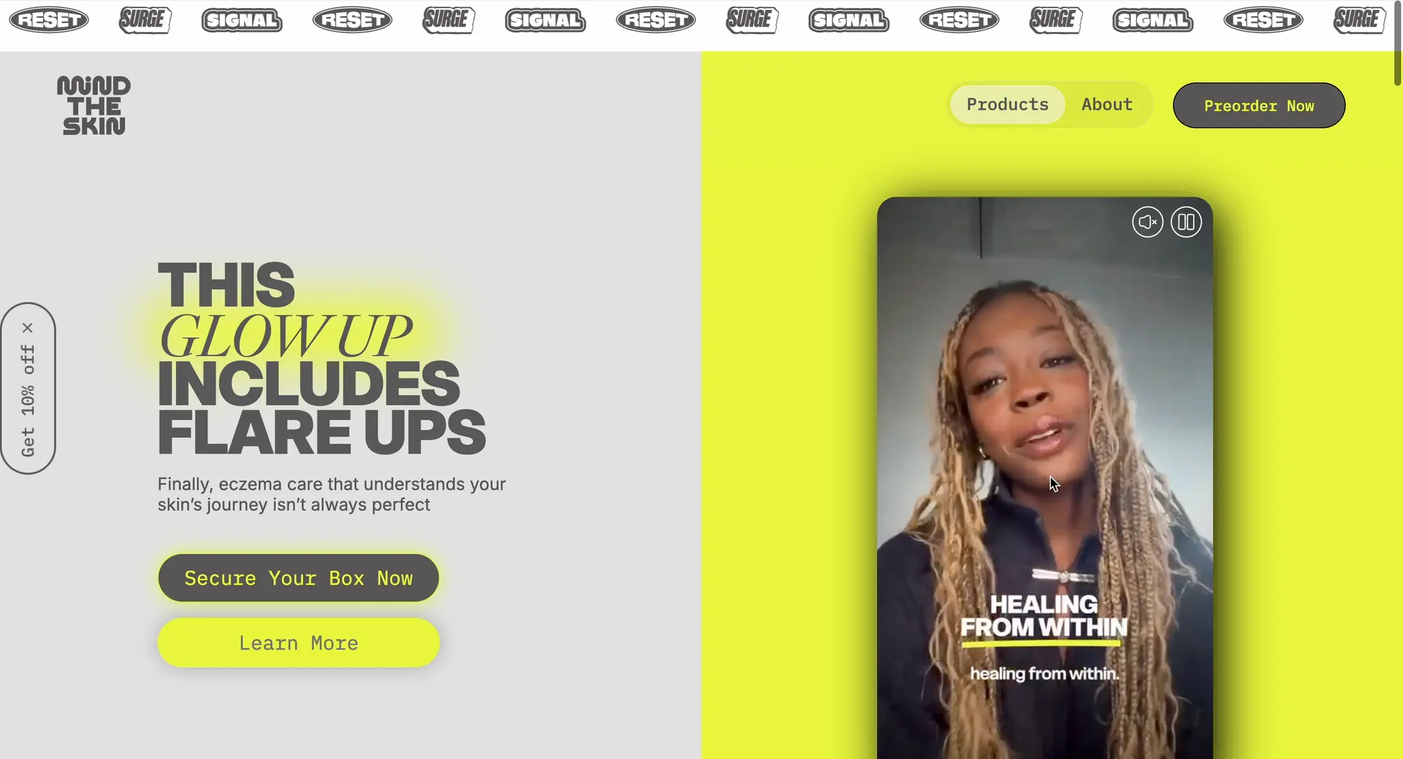 Mind The Skin homepage hero split between the headline “This glow up includes flare ups” with Secure Your Box and Learn More buttons, and a vertical creator video on an acid-yellow panel.