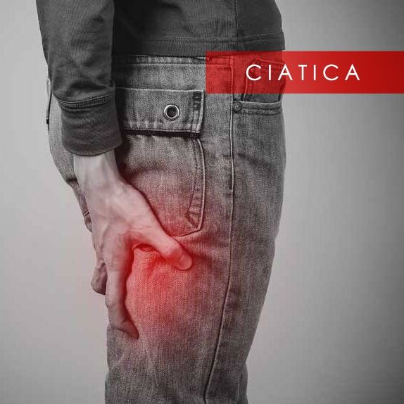 LA CIÁTICA: SÍNTOMAS, CAUSAS Y TRATAMIENTO