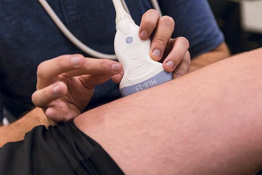 PUNCIÓN SECA MIOFASCIAL OBELION