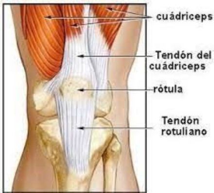 Tendinitis rotuliana.