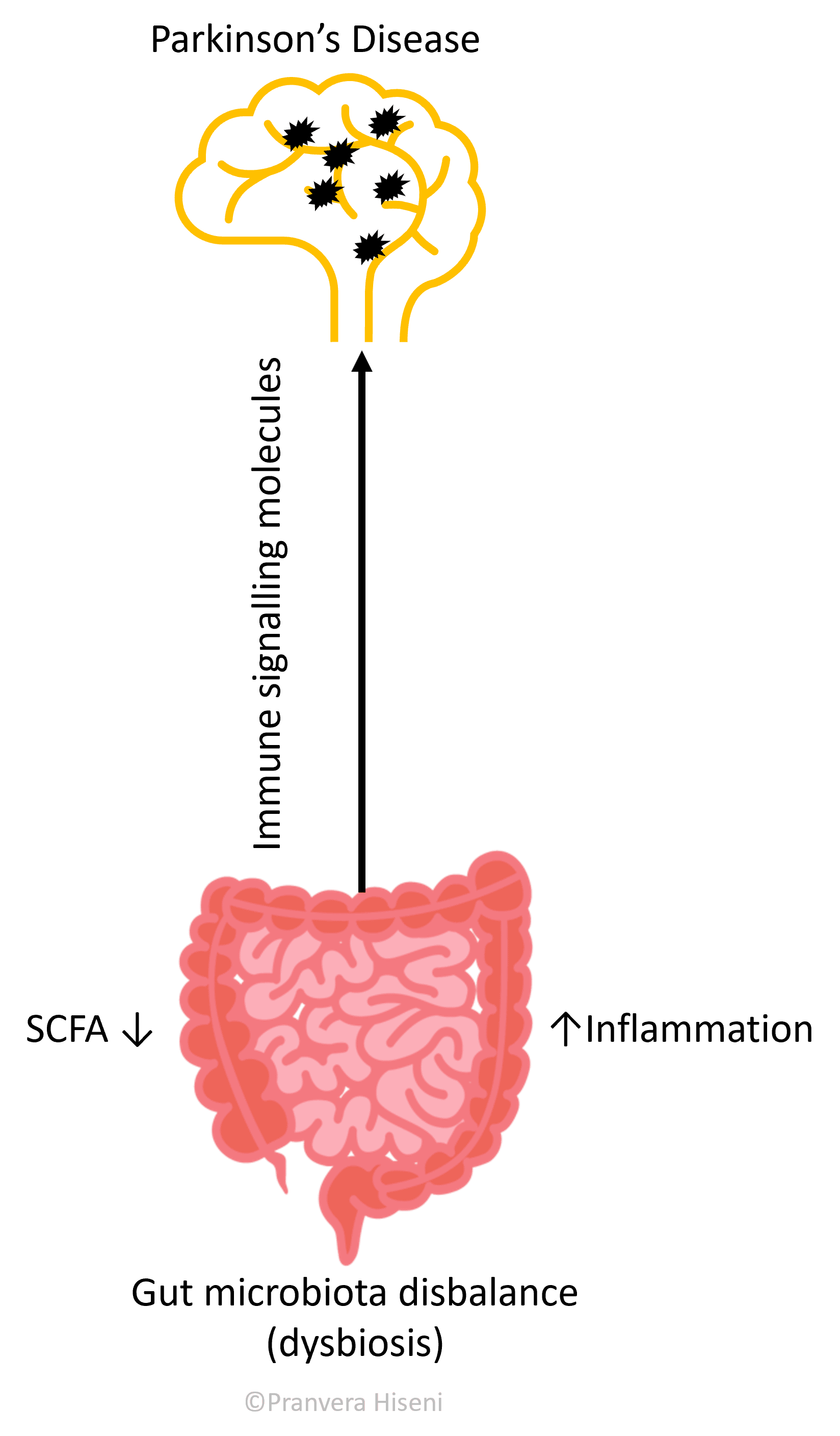 Link between the gut and Parkinson’s Disease illustration.