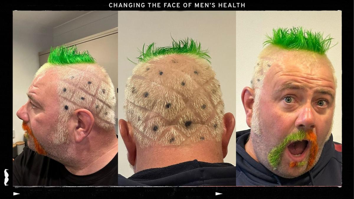 Jamie Settle styled hair like a pineapple images from the front, side and back