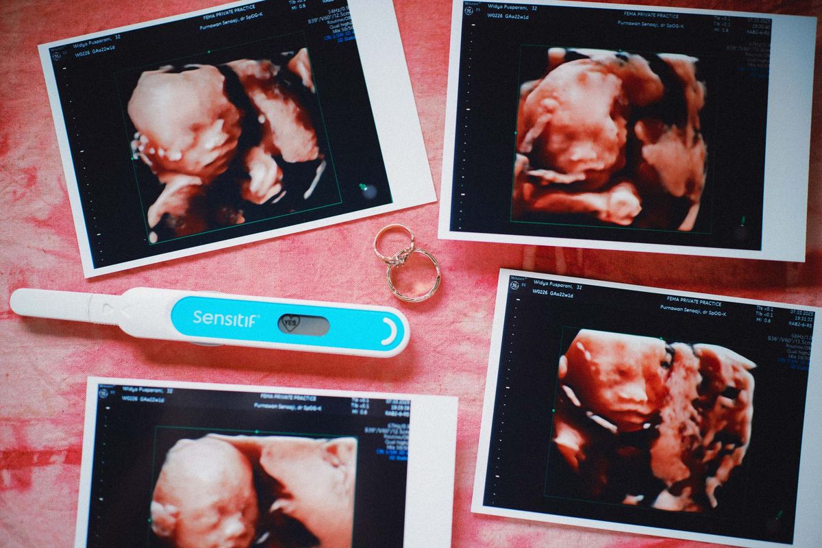 Rani & Helmi Babymoon — Bali photography by Selalu Berkesan