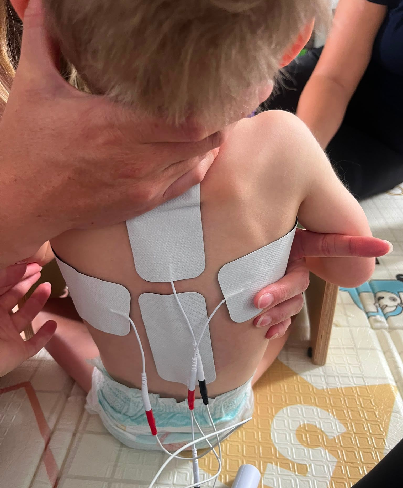Non-Invasive Spinal Electrical Stimulation (NISE-Stim)