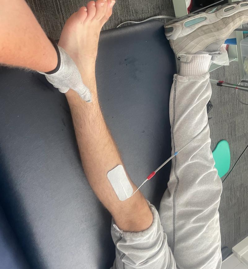 An electrode placed on a client's lower leg during a Neubie session
