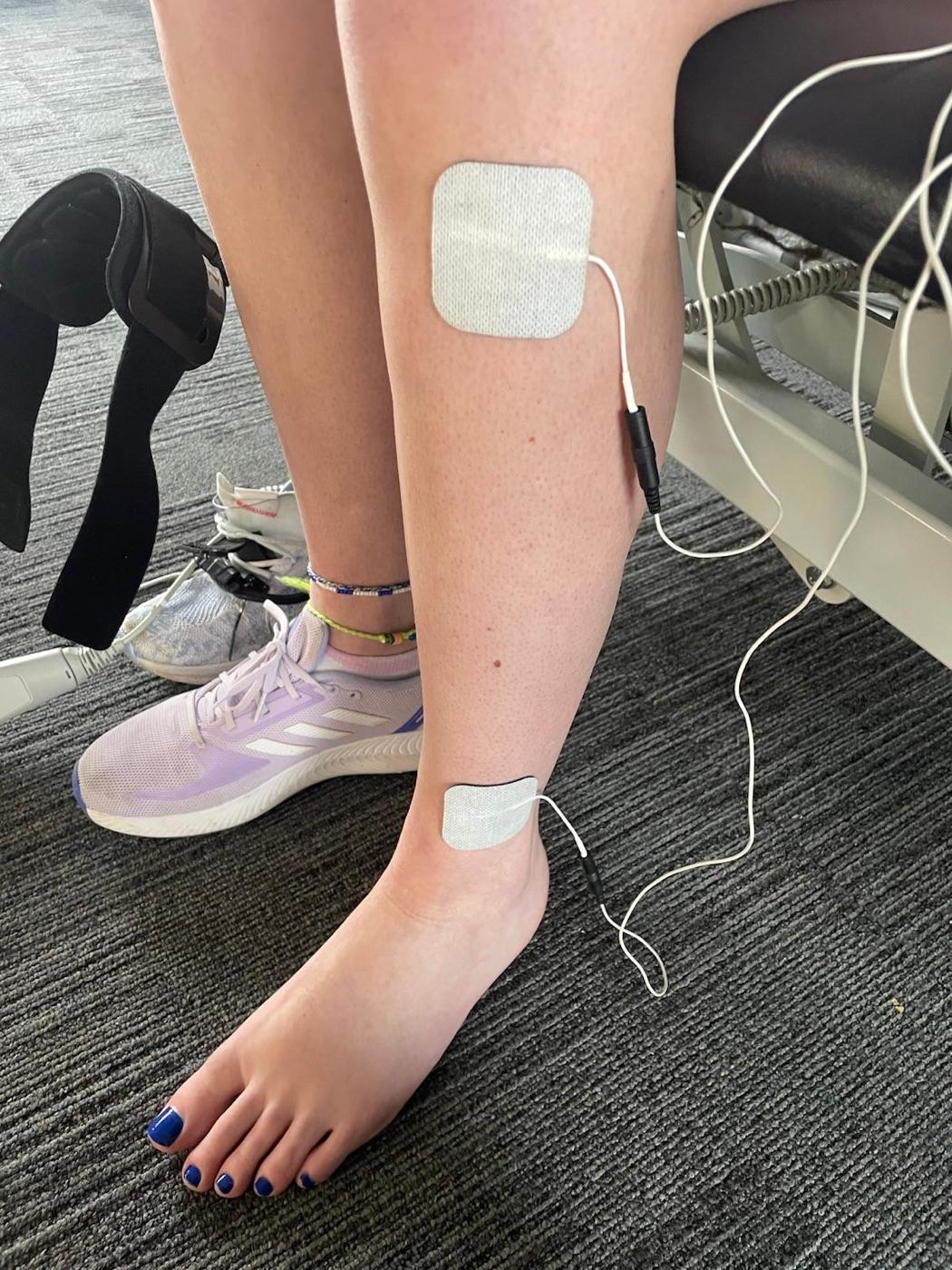 Functional Electrical Stimulation (FES)