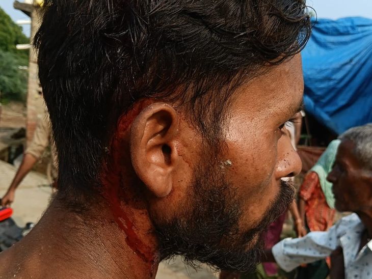 कानपुर में रास्ते के विवाद में गर्भवती महिला घायल, हमला और मामला दर्ज