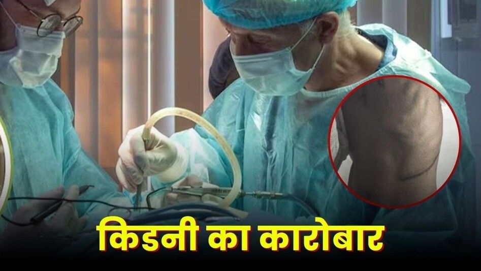 कानपुर: किडनी रैकेट में ड्राइवर-सर्जन गिरफ्तार, बिस्तर पर नोटों की गड्डियां