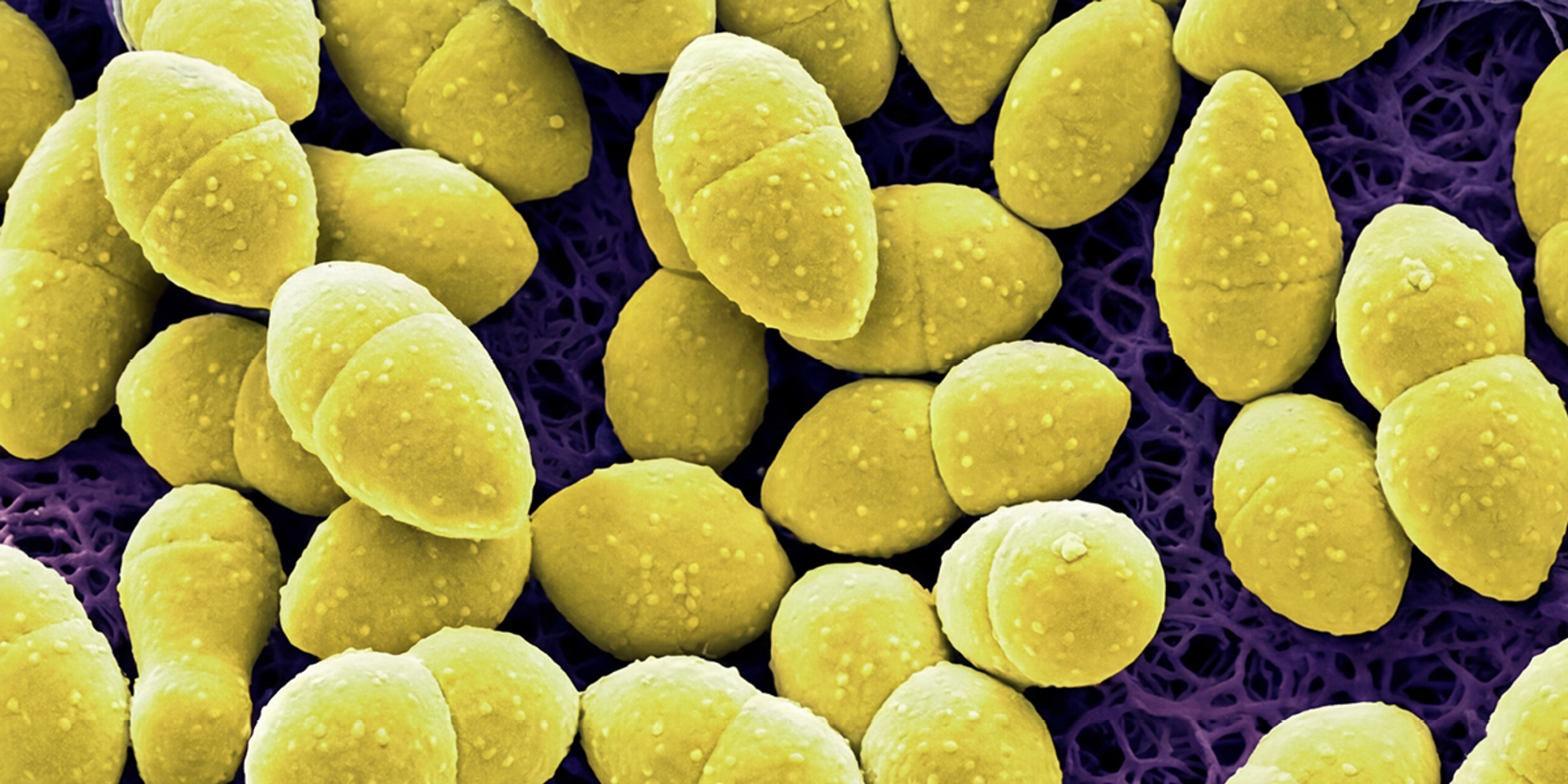 Scanning-elektronenmicrograaf (SEM) van Lactococcus-bacteriën uit kefir.