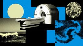 AI tool helps diagnose cancer 30% faster