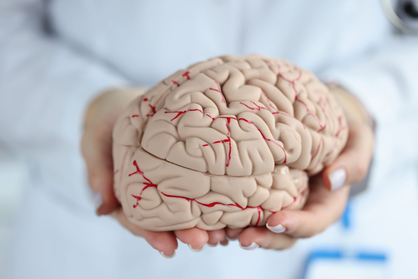 ¿Por qué importa en qué arteria está mi aneurisma cerebral?
