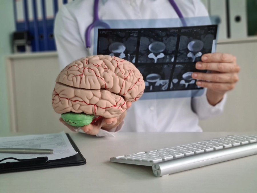 ¿Es suficiente llevar el reporte o también necesitan ver mis imágenes del cerebro?