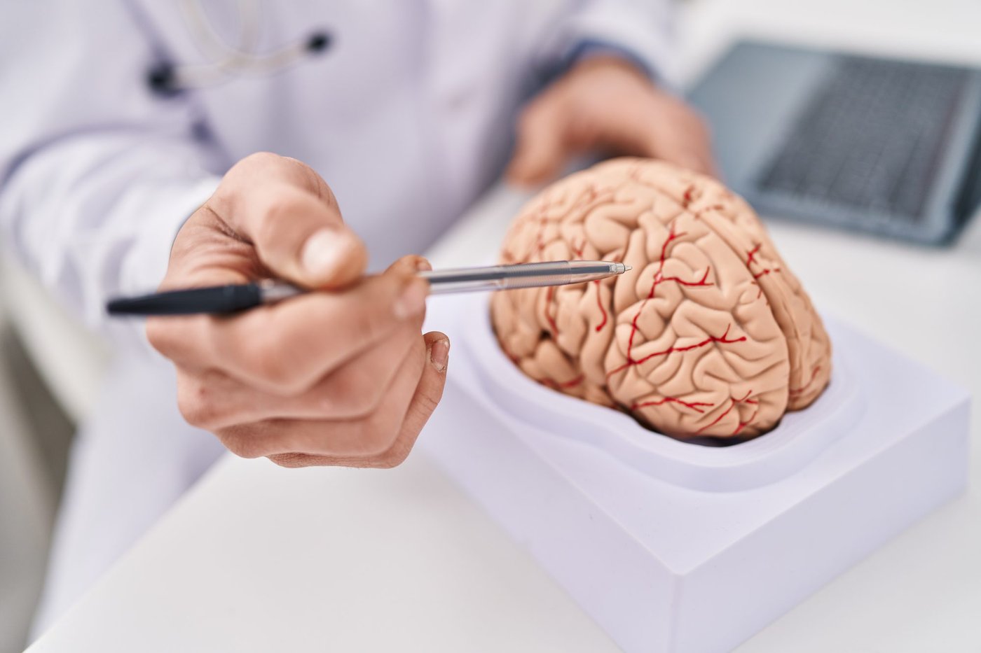 Si mi aneurisma cerebral es pequeño, ¿por qué me proponen tratarlo?