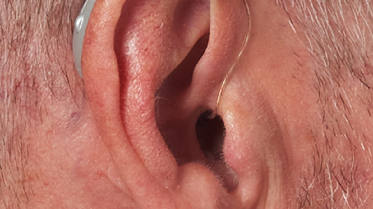 Best RIC Hearing Aid for Senior Citizens in India (2026 Guide)