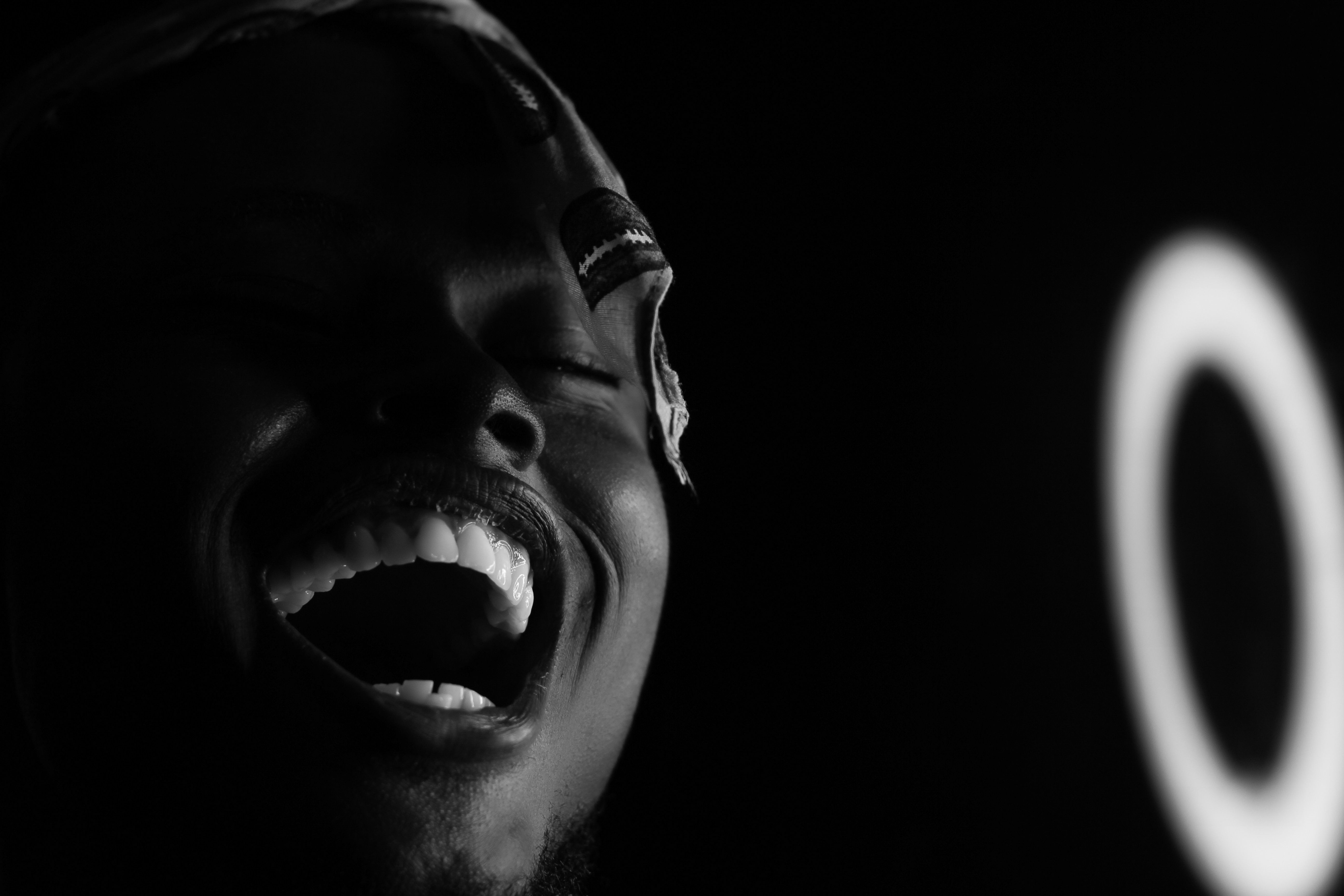 Why Professional Teeth Whitening Outshines AtHome Kits Choose Quality