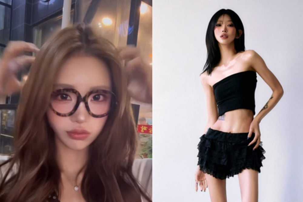 Choi Jun Hee’s paper-thin legs draw attention, weight loss from 96kg to 41kg: “My body is the best-looking”