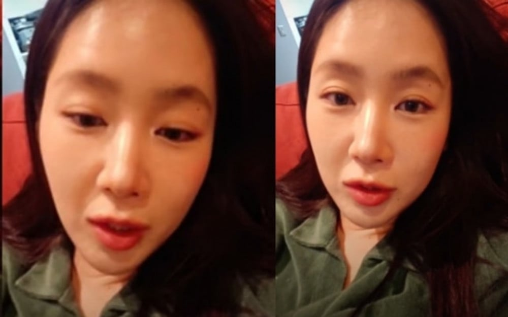 Soyou responds to plastic surgery rumors