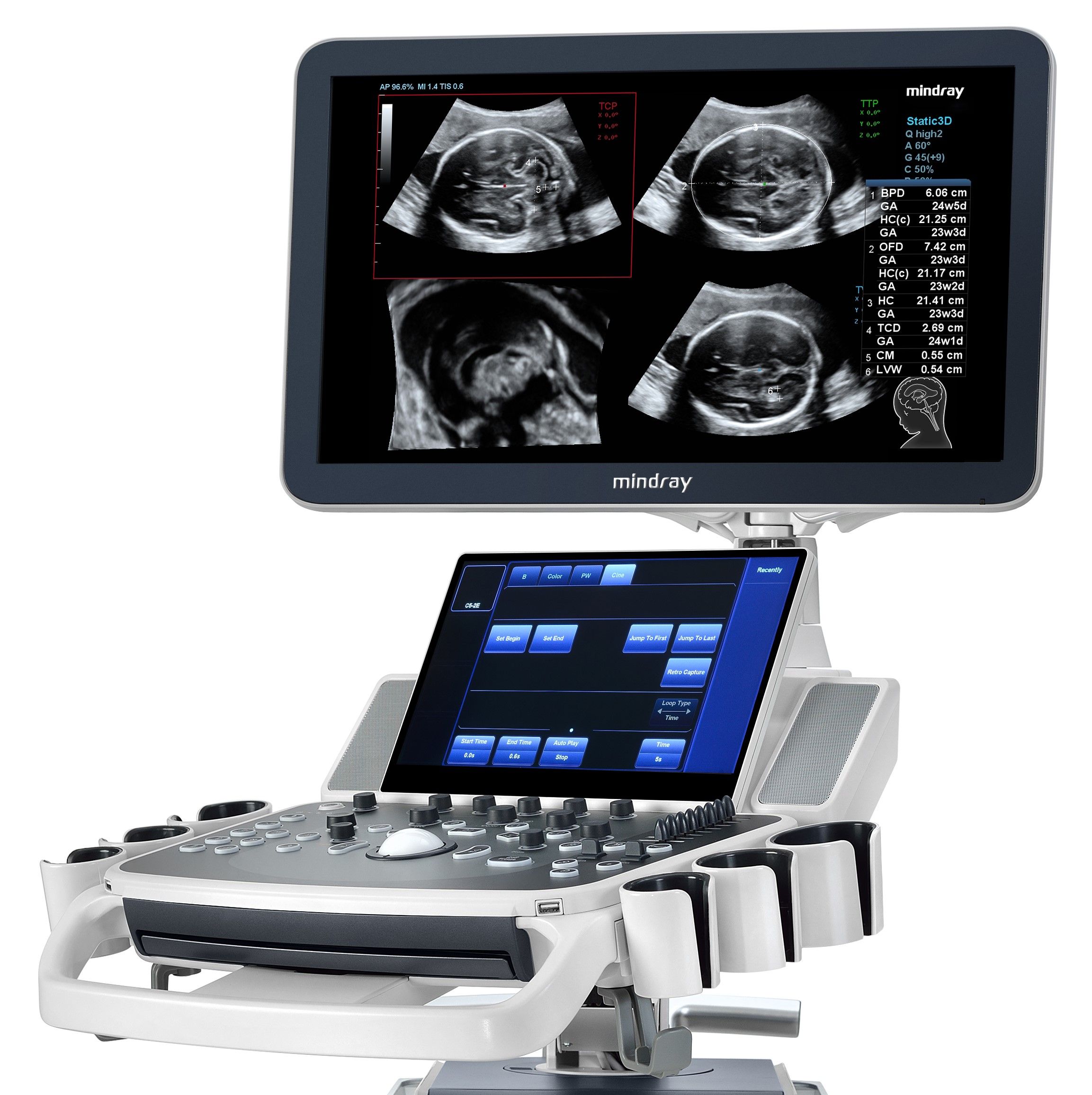 Mindray DC70 Ultrasound Ssystem With X-Insight Ultra Select, 45% OFF