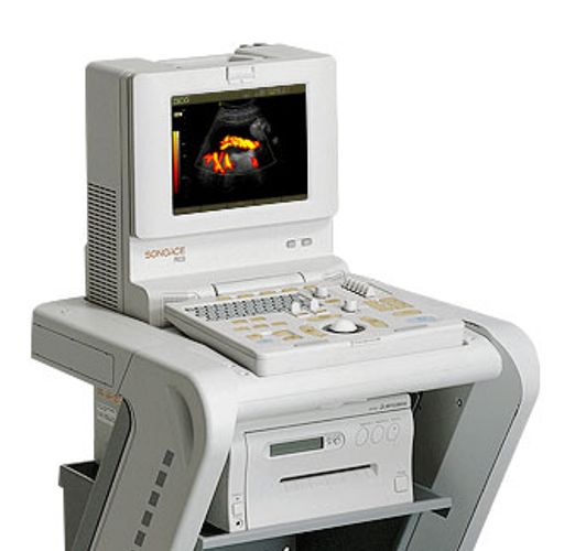 Lysis | Medison | SonoAce Pico Ultrasound System