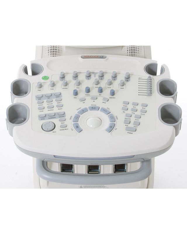 Lysis | Medison | SonoAce X8 Ultrasound System