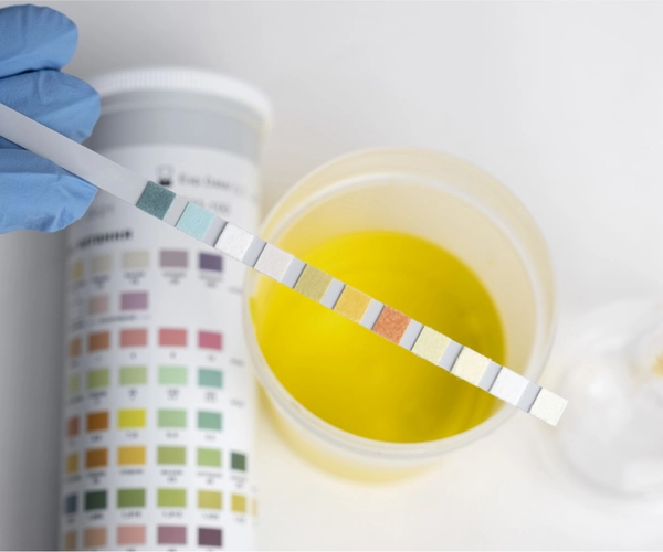 Teste de Urina Multidroga