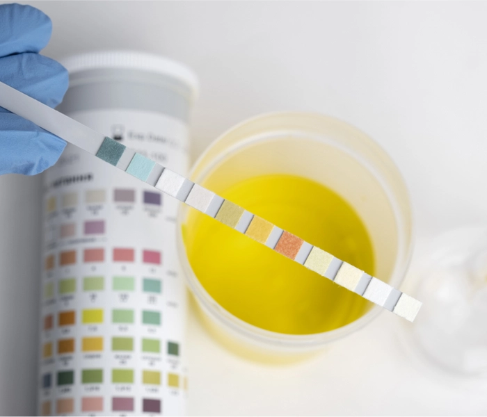 Teste de Urina Multidroga