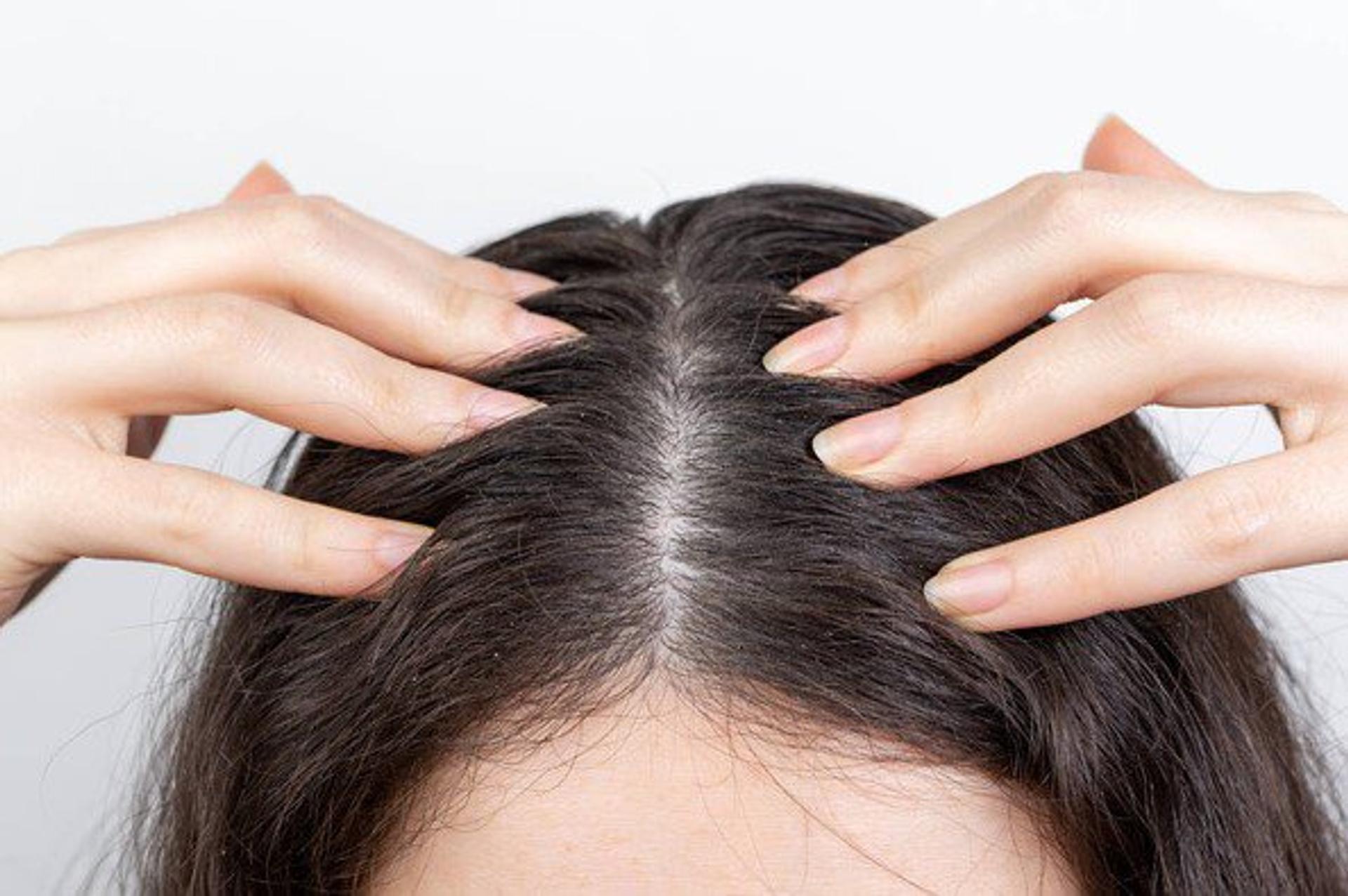 Photo of just the top of a woman's head and scalp