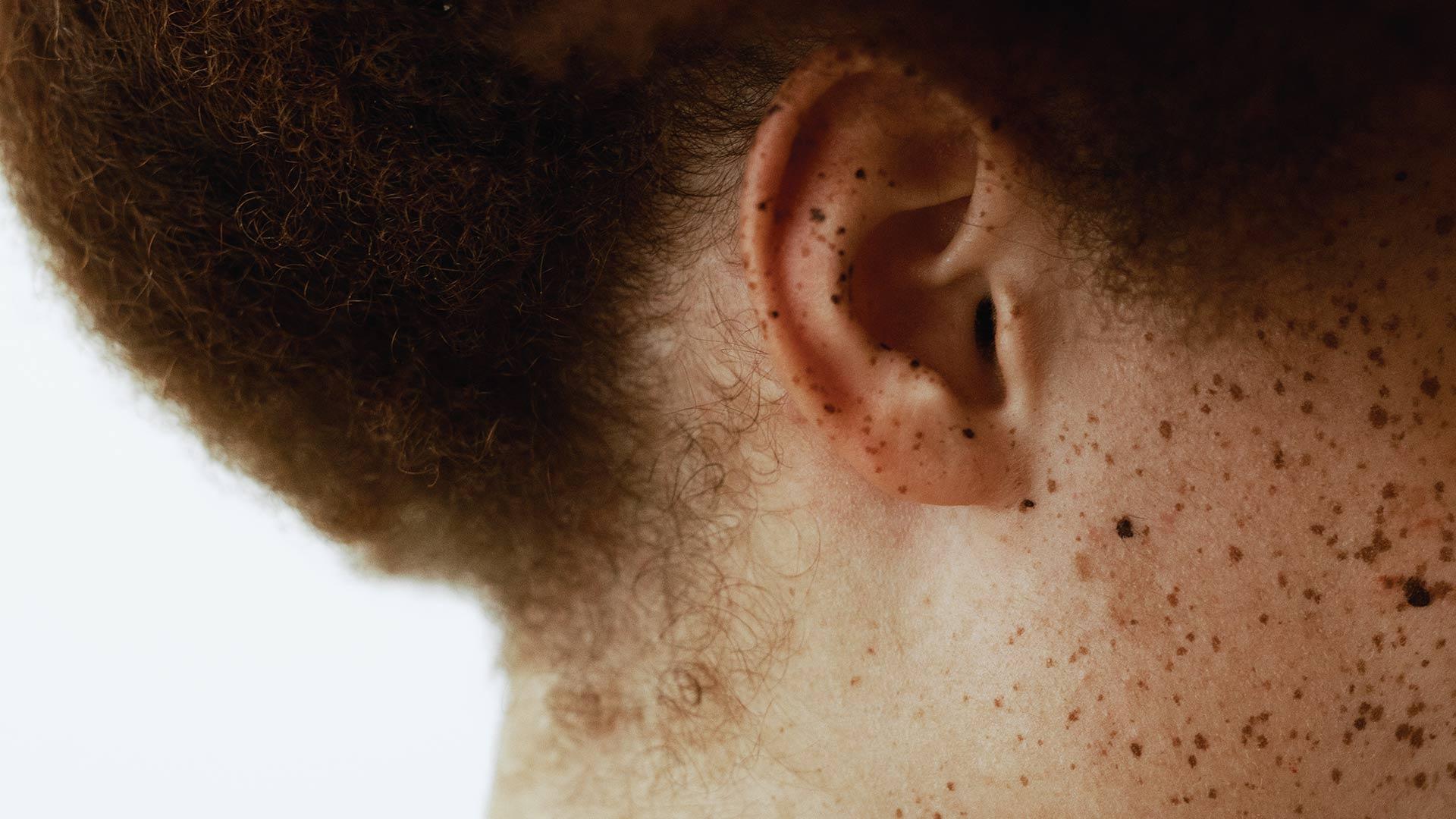 Partial image of the side of a womens face and ear with ginger afro hair and freckles