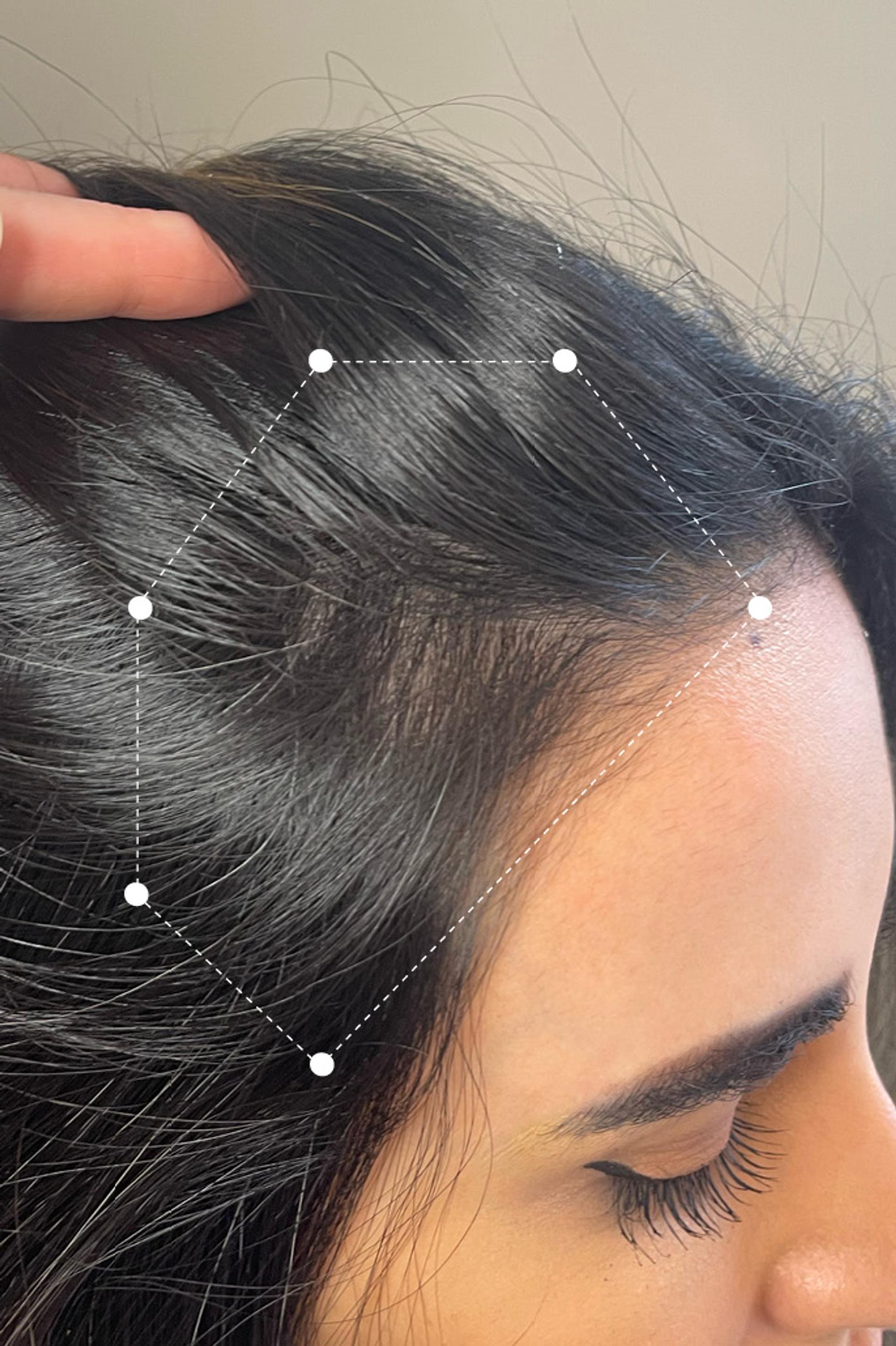 Side of head close up of black haired woman's hair and scalp after 3 months on the Harklinikken Regimen