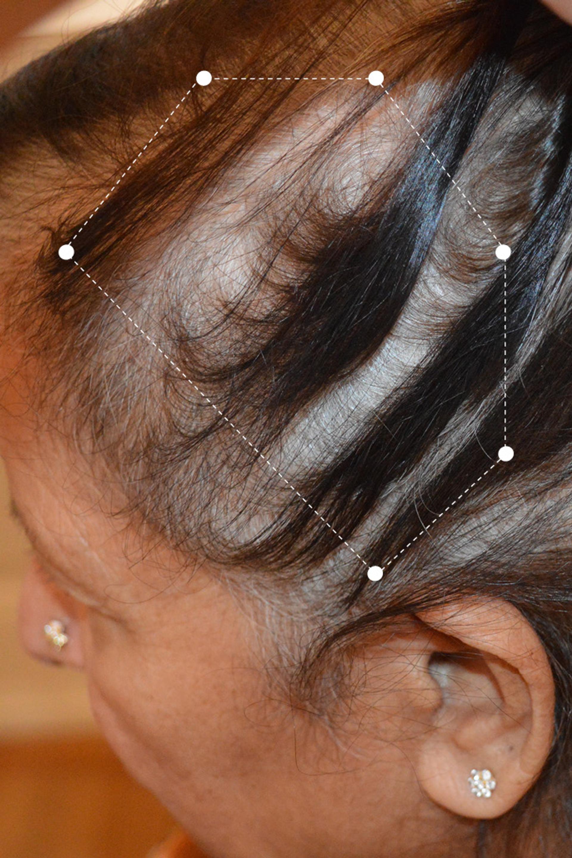 Side of head close up of dark grey haired over 60s woman's hair and scalp before going on the Harklinikken Regimen