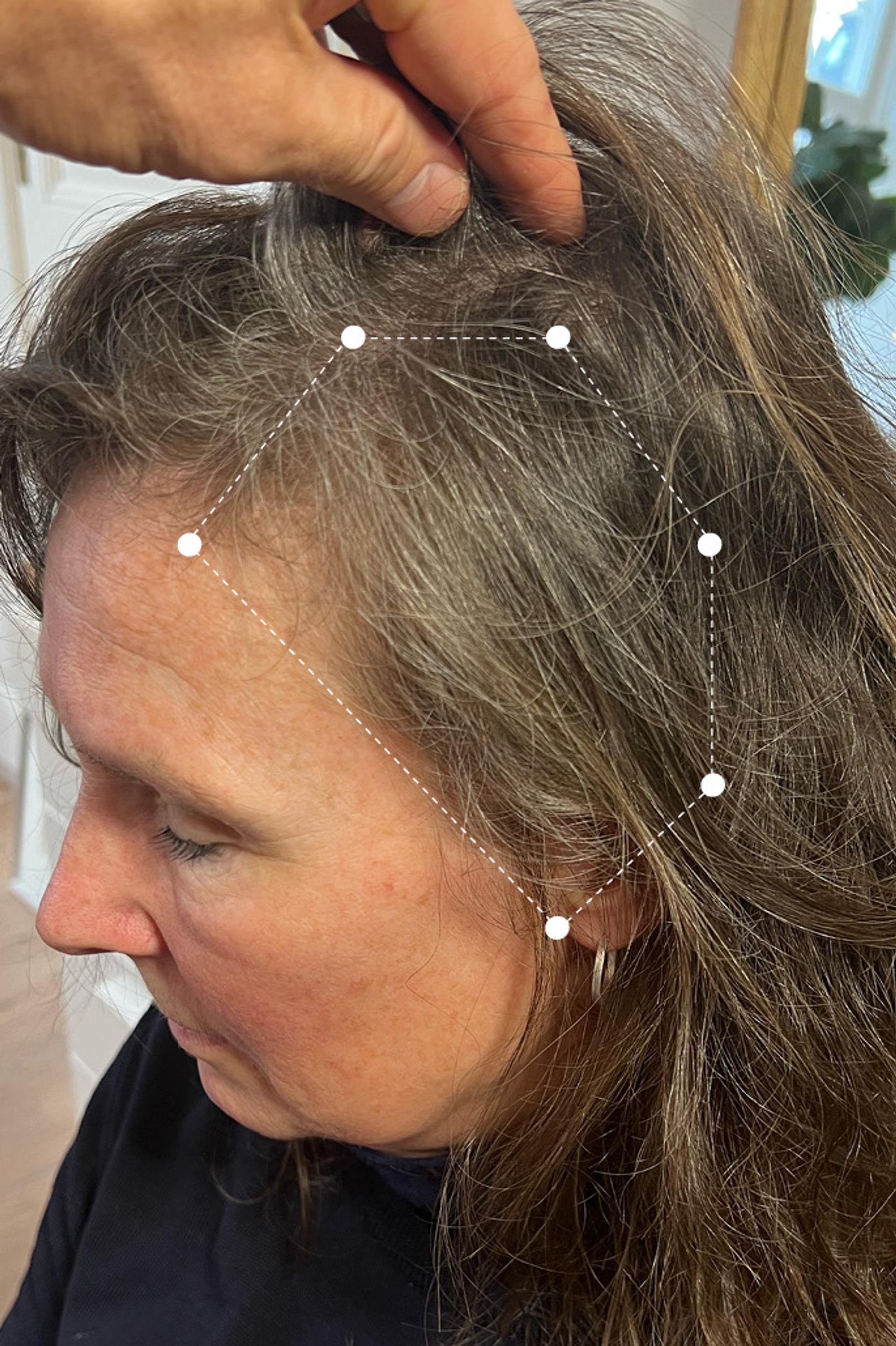 Side of head close up of brunette woman's hair after 18 months on the Harklinikken Regimen