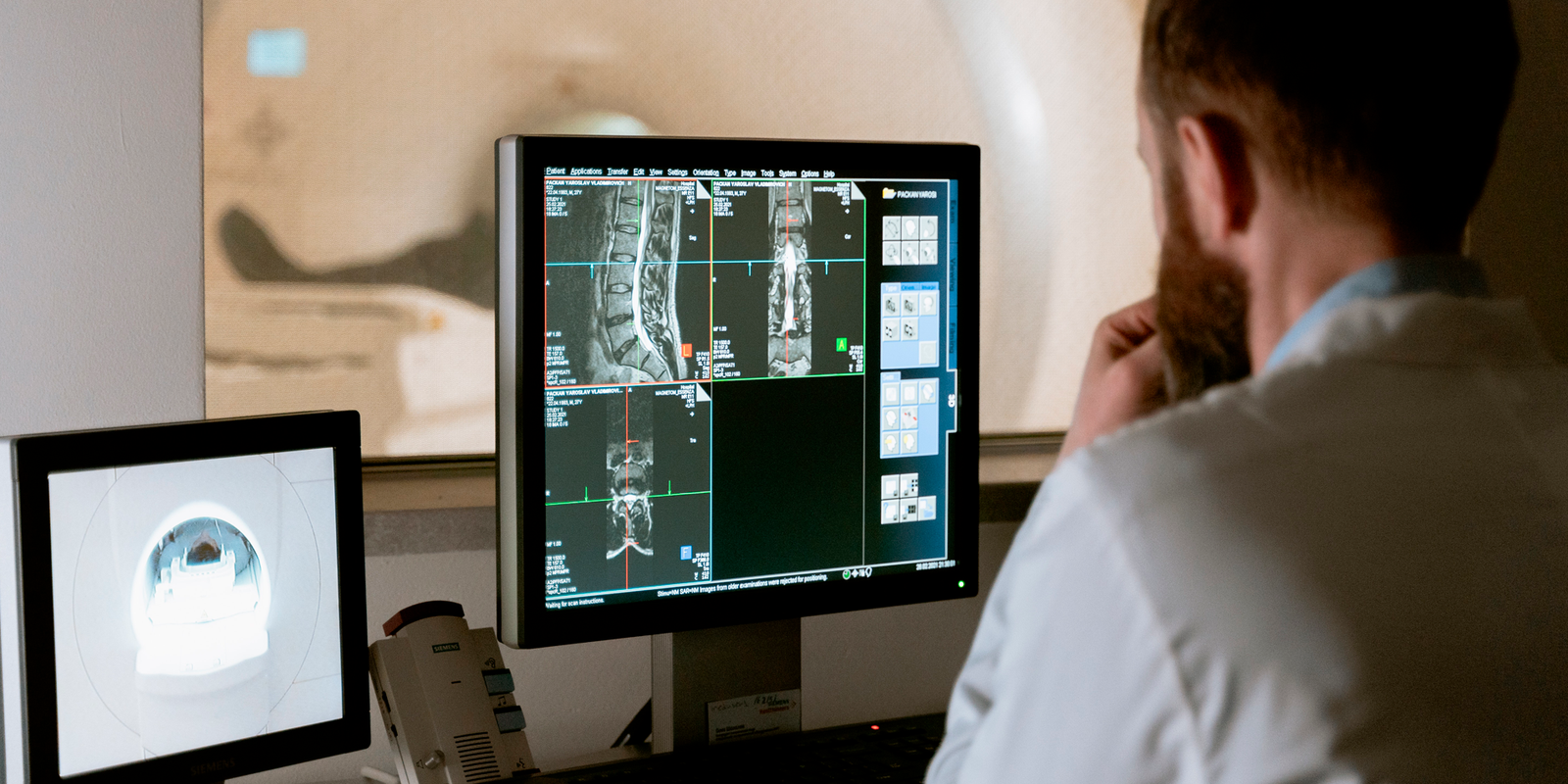 La tomografía computarizada (TC) es una tecnología médica que combina rayos X y procesamiento por computadora.