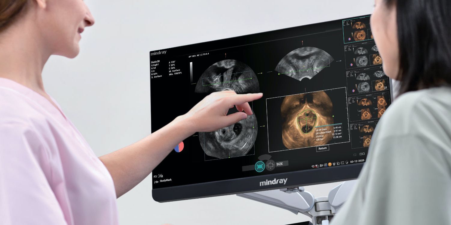 Un ecógrafo es un dispositivo médico que utiliza ondas de ultrasonido de alta frecuencia para crear imágenes en tiempo real del interior del cuerpo humano.