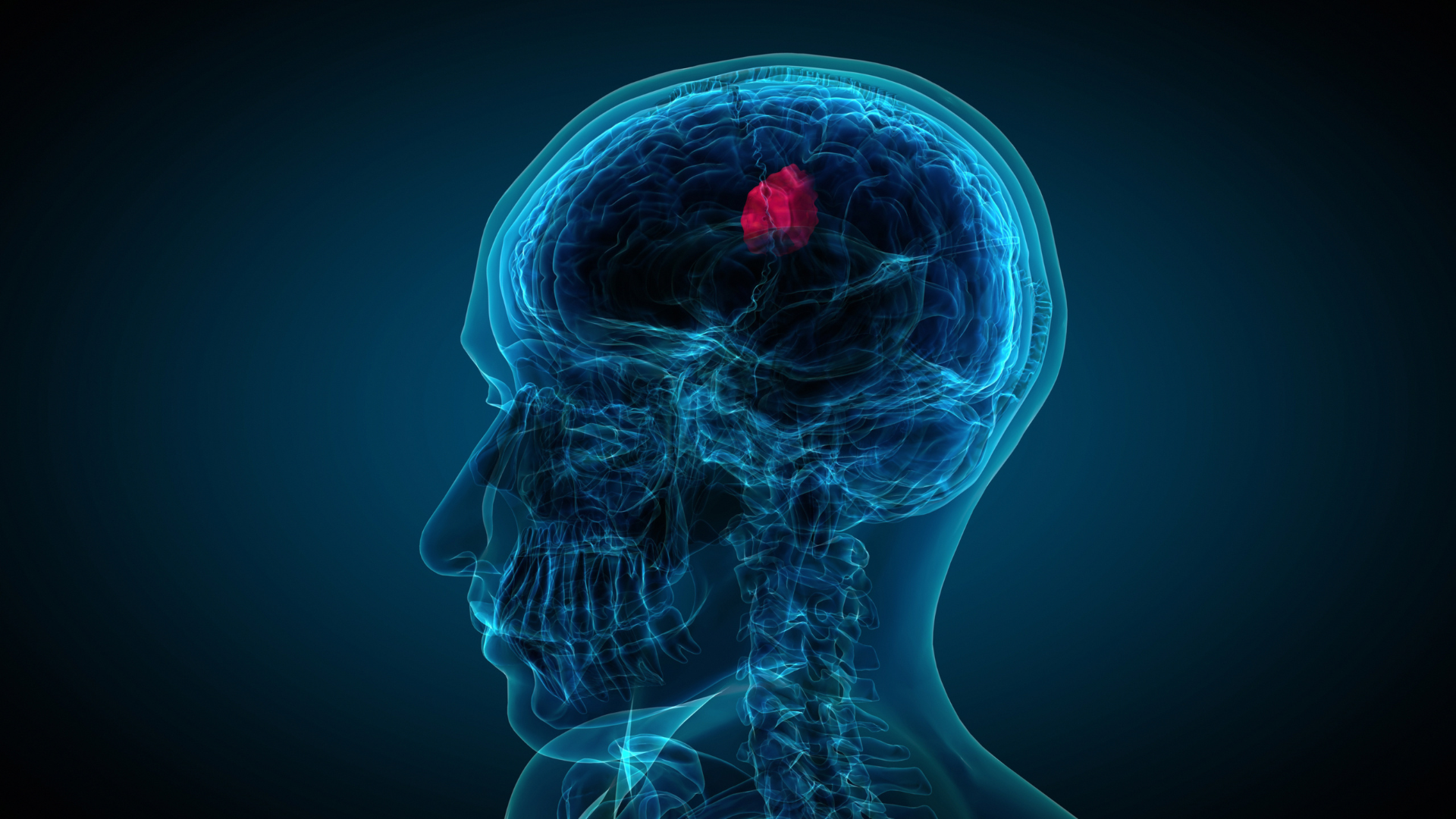 New Collaboration Between American Cancer Society and Brain Tumor Network Connects Patients With Brain Tumors to Free, Specialized Support