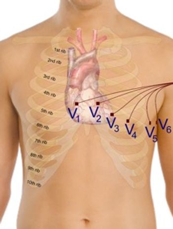ECG figure 1.jpg