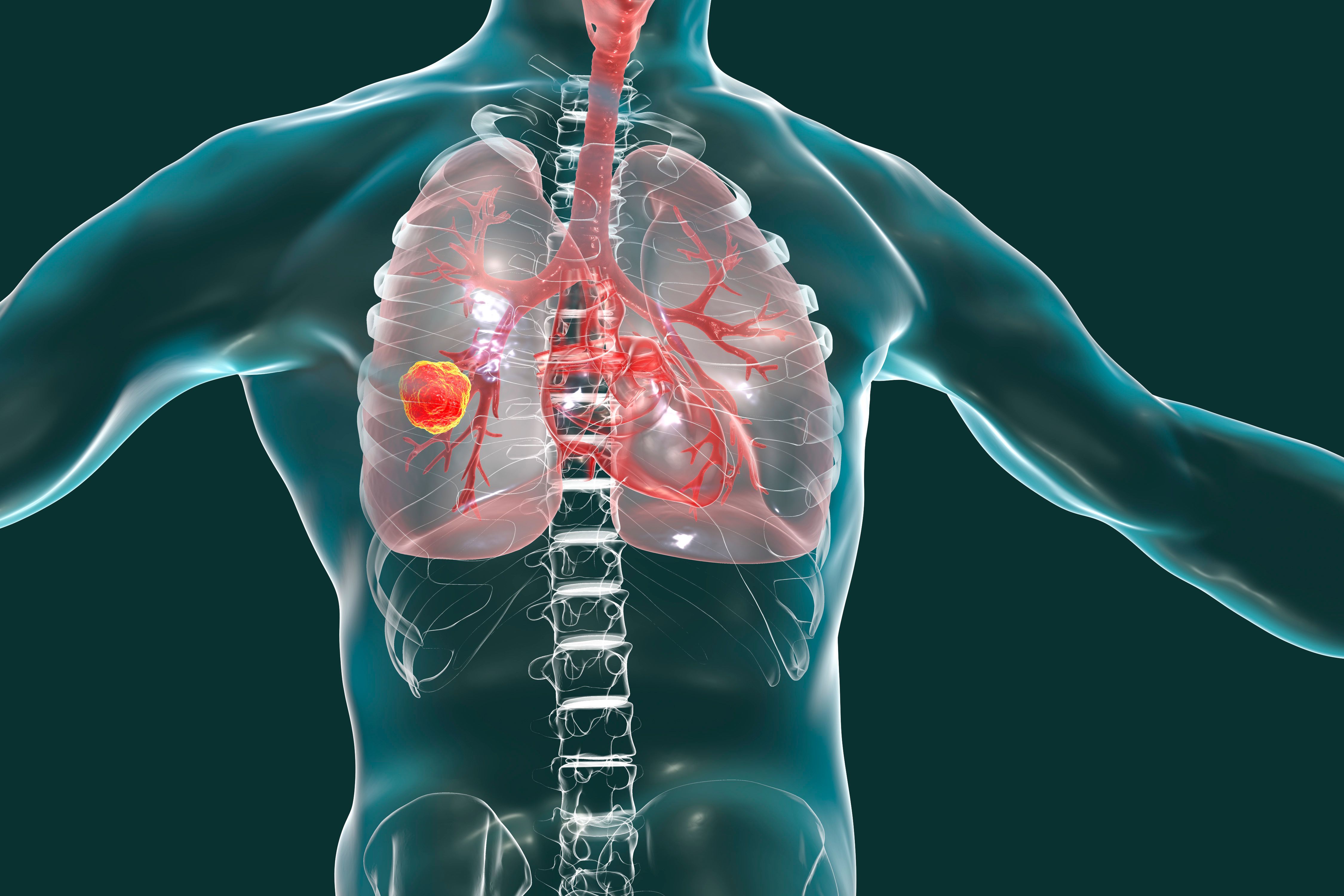 Results from TROPION-Lung05, TROPION-Lung01 Trials Lead to