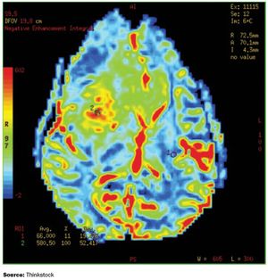 The Evolution of Imaging Techniques in Clinical Trials