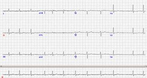 Afib figure 1.jpg