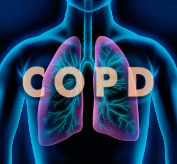 Credit: peterschreiber.media | stock.adobe.com. Phase 3 MATINEE trial shows Nucala (mepolizumab) significantly lowers COPD exacerbation rates in eosinophilic patients on triple therapy, supporting targeted biologics.
