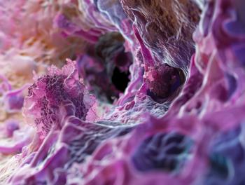 Credit: Johannes | stock.adobe.com. View of cancerous squamous cell carcinoma in the esophagus through a microscope. Concept Medical Imaging, Cancer Research, Squamous Cell Carcinoma, Esophageal Diseases