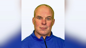 15 ‘Shades’ of Change in Clinical Trial Start-Up and Execution