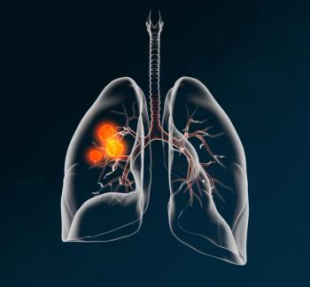 Image credit: Axel Kock | stock.adobe.com