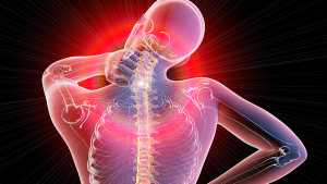 Tonix Pharmaceuticals, Rho Inc. to Collaborate on New Drug Application for Fibromyalgia Treatment