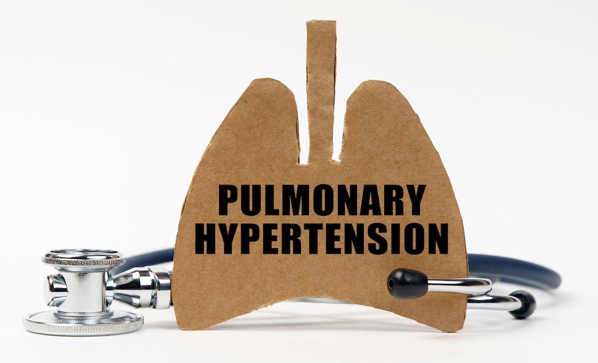 pulmonary hypertension graphic | Image Credit: Dzmitry - stock.adobe.com