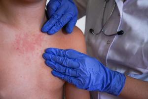 Image Credit: © Ирина Старикова - stock.adobe.com