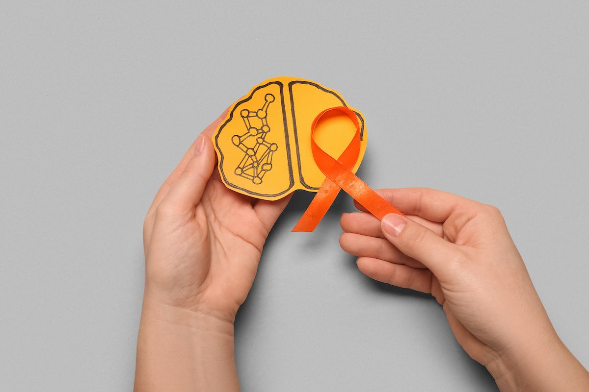 MS ribbon and brain drawing | Image credit: Pixel-Shot - stock.adobe.com
