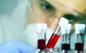 blood test | Image credit: barbol - stock.adobe.com